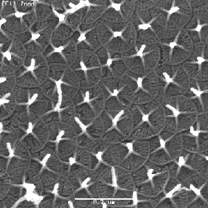 organic  scales with spines (SEM)