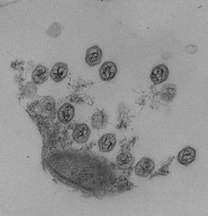 Vue au microscope