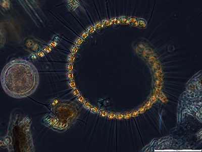 BioPIC Microscopie champ large exemple © Laurent Intertaglia (LBBM/Bio2Mar) / OOB